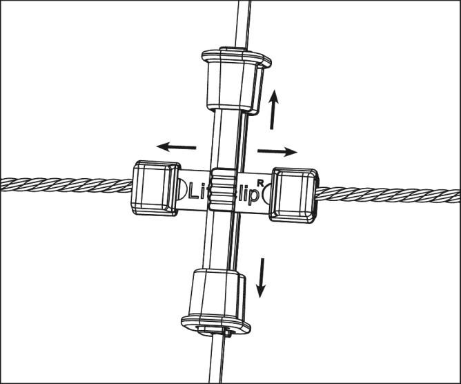 Litzclip Kit di riparazione per rinforzi verticali